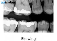高精度な歯科X光線機械携帯用歯科X光線の単位1年の保証
